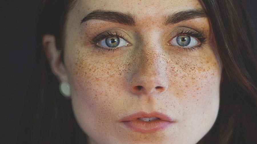 چگونه لک پوستی را درمان کنیم؟