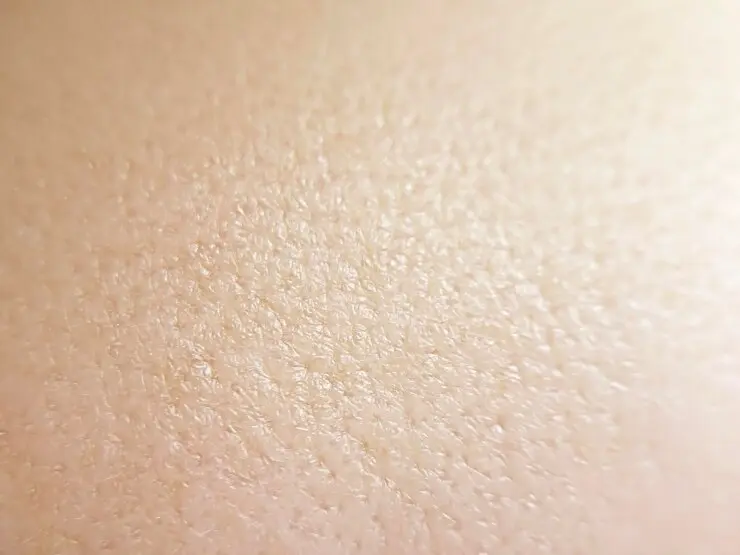 نیاسینامید یا رتینول؛ کدام برای منافذ باز پوست بهتر است؟